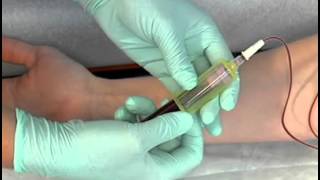 Sample Procedure  Venipuncture Butterfly Method [upl. by Kcirej794]