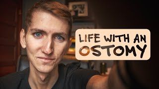 Living With An Ostomy [upl. by Morganica21]