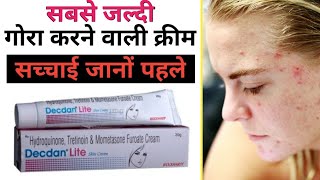 Skin lite vs skin shine creams reviewinstant fairness skin whitening cream review side effects [upl. by Drusi]