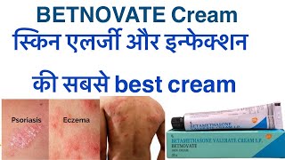 Betnovate skin cream uses in hindibetnovate cream ke kya upyog hai fayde haicandid creamzole f [upl. by Ailet]