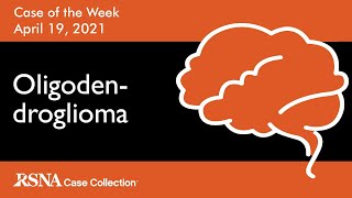 Case of the Week Oligodendroglioma [upl. by Ingar323]