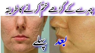 chehre ke gadde khatam karne ka tarika  how to get clear face skin  ziks biks [upl. by Brandt]