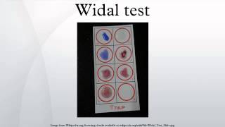 Widal test [upl. by Maitilde]