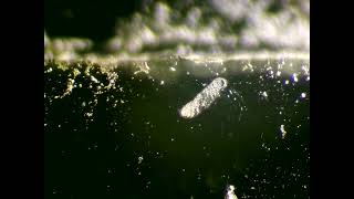 Protists and a bdelloid  rotifer  Raw vid II [upl. by Elag]