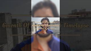 Hair Growth Timelapse  6months 180 Days shorts hairgrowth timelapse longhair [upl. by Enileuqcaj243]