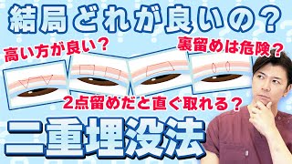 高い埋没法と安い埋没法 一体何が違うの？？ 良い埋没法の種類を見抜く方法教えます！【水の森美容クリニック】 [upl. by Bigler489]