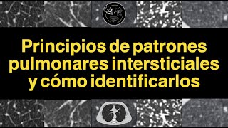 Principios de patrones pulmonares intersticiales y cómo identificarlos [upl. by Danell]