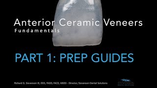 Anterior Ceramic Veneers Part 1 Preparation Guides [upl. by Breana]