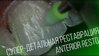 Реставрация в деталях  Restoration in detail [upl. by Gaye]