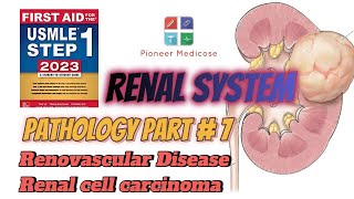 Renal Cell Carcinoma and Renovascular Diseases for USMLE step 1patho Part7First Aid in UrduHindi [upl. by Ehtiaf]