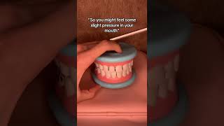 Tooth Removal asmr asmrvideos satisfying [upl. by Onitnatsnoc]