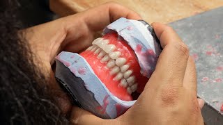 How to Make Dentures  The Process of Making Dentures [upl. by Eide84]