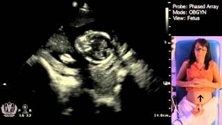 Obstetric Ultrasound Basics with Fetal Heart Rate Calculation​  Made Simple [upl. by Eatnoled]