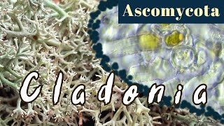 Cladonia arbuscula under the Microscope Mosslike lichensAscomycota [upl. by Initof]