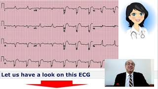 EKG Trainer Case 3 Questions [upl. by Kirst]