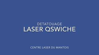 Detatouage laseravant  apres [upl. by Adriell]