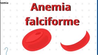 O que é Anemia Falciforme [upl. by Ateloj]