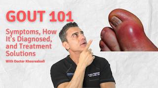 Gout 101 Symptoms How Its Diagnosed and Treatment Solutions [upl. by Adnocahs]