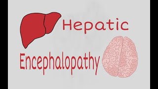 Hepatic Encephalopathy [upl. by Asia]