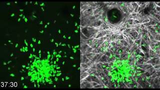 Neutrophils swarming to sites of injury [upl. by Sillihp]