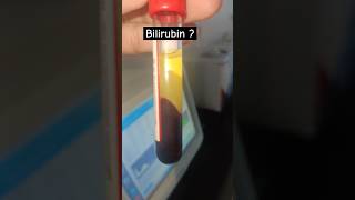 Bilirubin kitna hailab technologist status labstatus shorts pathology bloodtest scienceaiims [upl. by Anesor]