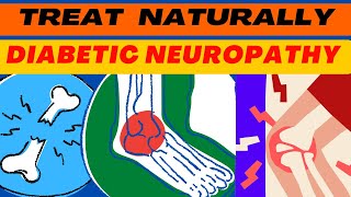 DIABETIC NEUROPATHY  How Capsaicin Use for Diabetic Neuropathy diabetes neuropathy painrelief [upl. by Inait705]