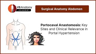 Portocaval Anastomosis Key Sites and Clinical Relevance in Portal Hypertension [upl. by Jeannette]