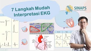 SINAPINTAR 02  Pt 02 7 Langkah Cara Interpretasi EKG Kelainan Ruang Jantung AtriumampVentrikel [upl. by Powel]