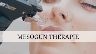 Mesotherapie mit der Mesogun  Dr Benjamin Gehl [upl. by Arihat]