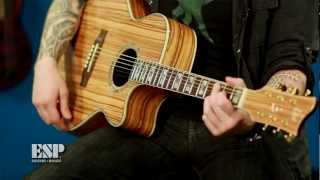 ESP Guitars Guitar of the Week  LTD Xtone Exotic Wood Acoustics [upl. by Lissi]