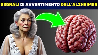 SCIENTIFICO Queste 5 Abitudini Sono Legate allAlzheimer [upl. by Dnomyaw]