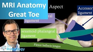 Great toe MRI Anatomy  First metatarsophalangeal joint [upl. by Lyns]