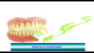 Dentaduras postizas ¿cómo usar las cremas adhesivas [upl. by Rudwik]