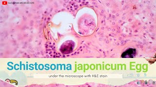 Schistosoma japonicum egg in liver under the microscope with Haematoxylin and Eosin HampE stain [upl. by Tallia]