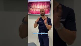 Can Invisalign Be Used With Jaw Surgery [upl. by Pontus]