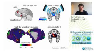 Lennart Verhagen  Modulating Deep Brain Circuits With LowIntensity FUS 2020 [upl. by Nicolai429]