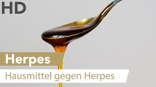 Herpes an der Lippe Dieses natürliche Hausmittel kann helfen [upl. by Kieger]