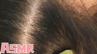 ASMR丨Mens scalp care immersive cleaning antiitching [upl. by Quintina]