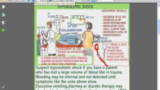 SESSIONS for NURSES 9  THE PATIENT IN HYPOVOLEMIC OR SPINAL SHOCK [upl. by Ehc]