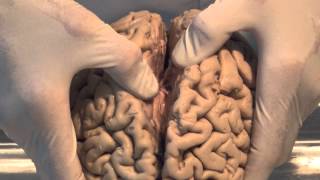 Introduction Neuroanatomy Video Lab  Brain Dissections [upl. by Ydnim]