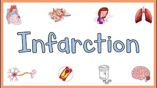 Infarction  Causes Types Morphology amp Factors influencing development of infarction [upl. by Novel]