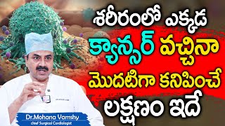 ఒంట్లో కాన్సర్ కణాలు ఉంటె కనిపించే సూచనలు  DrMohan Vamsi About Cancer  SumanTV Health [upl. by Kiri580]