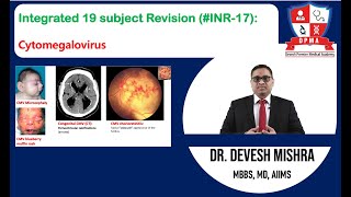 🕉 Integrated 19 subject Revision INR17 Cytomegalovirus by Dr Devesh Mishra [upl. by Arhaz]