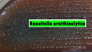 Raoultella ornithinolytica [upl. by Almond]