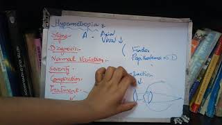 HYPERMETROPIA important topic full explanation part 2 [upl. by Drogin]