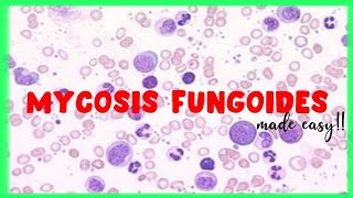 Mycosis Fungoides  WBC disorders  Sezary Syndrome [upl. by Baxy]