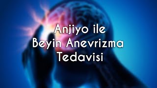 Anjiyo ile Beyin Anevrizma Tedavisi [upl. by Sopher]