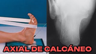 RADIOGRAFÍA DE CALCÁNEO AXIAL PLANTODORSAL MANUAL DE BOLSILLO 31 [upl. by Anayit]