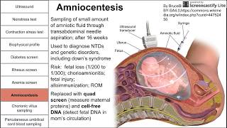 Prenatal screening fetal testing and other tests during pregnancy [upl. by Alejo119]