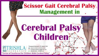 Scissor Gait Cerebral Palsy Management in Cerebral Palsy Children  Trishla Foundation [upl. by Anihpled]